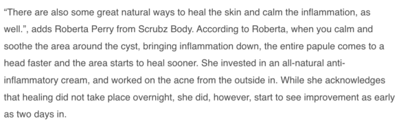 Roberta Perry on cystic acne
